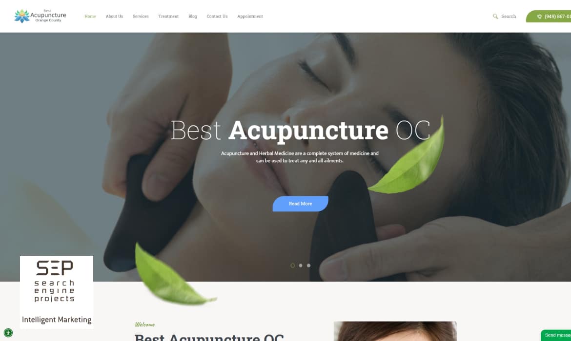 best acupuncture oc marketing